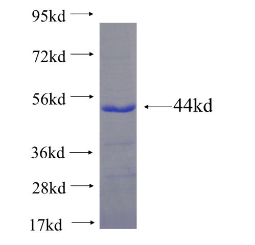 Recombinant human ECEL1 SDS-PAGE