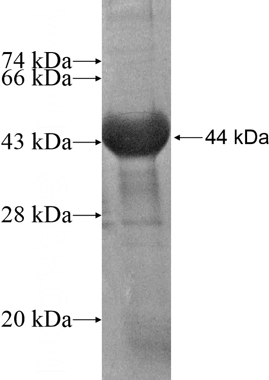 Recombinant Human ZFYVE9 SDS-PAGE