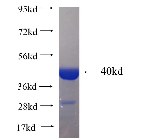Recombinant human SUFU SDS-PAGE