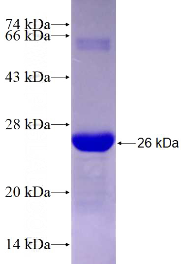 Recombinant Human SPATA17 SDS-PAGE