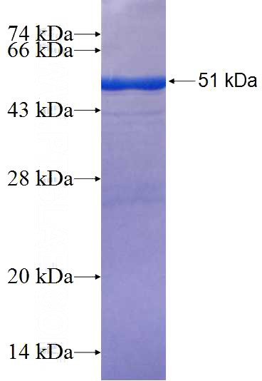 Recombinant Human VAPA SDS-PAGE