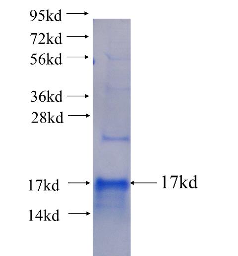 Recombinant human LASP1 SDS-PAGE