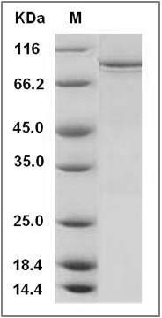 Human PDGFRa / CD140a Protein (His & GST Tag) SDS-PAGE