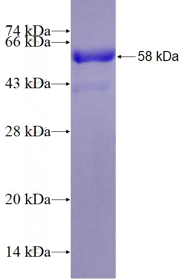 Recombinant Human CDH19 SDS-PAGE