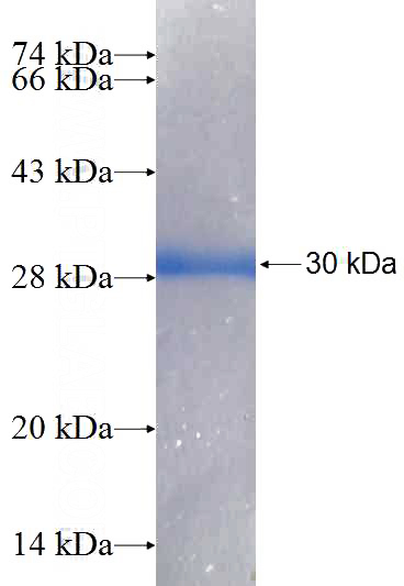 Recombinant Human GSTO1 SDS-PAGE