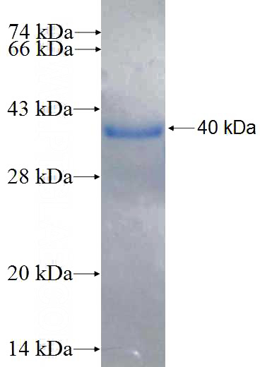 Recombinant Human MOCS3 SDS-PAGE