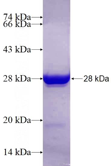Recombinant Human MBTPS1 SDS-PAGE