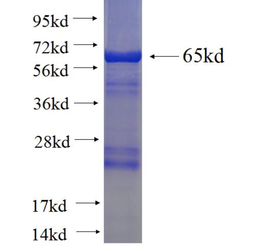 Recombinant human PRPSAP1 SDS-PAGE