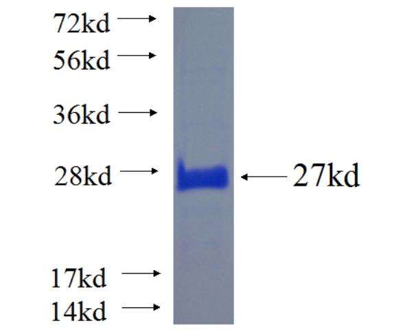 Recombinant human RNASE10 SDS-PAGE