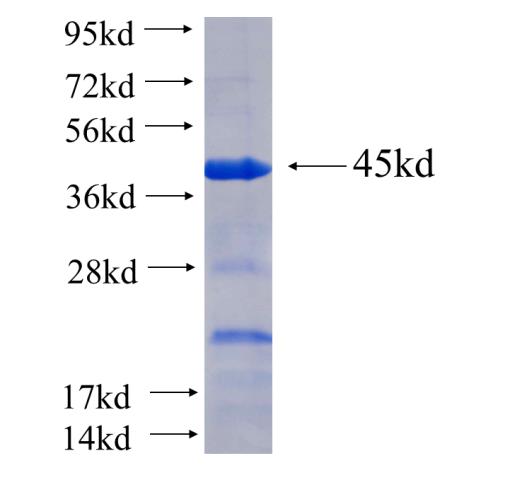 Recombinant human DDX46 SDS-PAGE