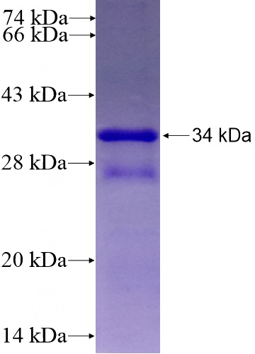 Recombinant Human ATXN7L1 SDS-PAGE