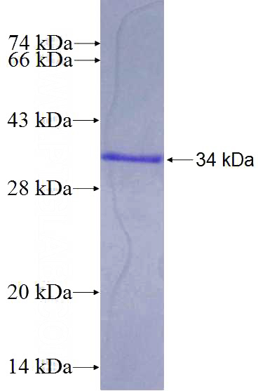 Recombinant Human COPB1 SDS-PAGE