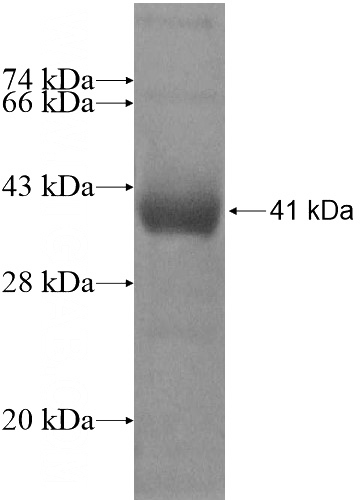 Recombinant Human TBC1D16 SDS-PAGE