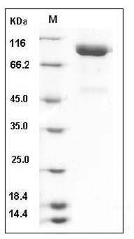 Human SLITRK4 / Slitrk4 Protein (His Tag) SDS-PAGE