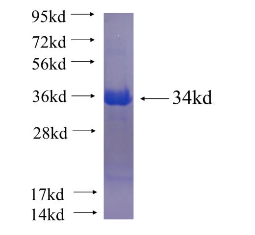 Recombinant human RNF103 SDS-PAGE