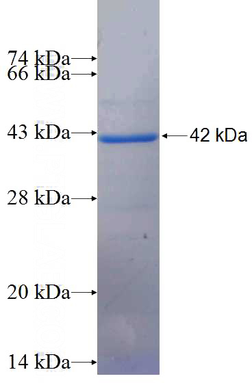 Recombinant Human GNAQ SDS-PAGE