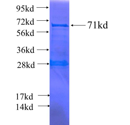 Recombinant human TFDP1(Full length) SDS-PAGE