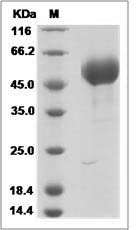 Influenza A H6N2 (A/chicken/Guangdong/C273/2011) Hemagglutinin / HA1 Protein (His Tag)