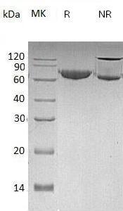 Human MMP2/CLG4A (His tag) recombinant protein