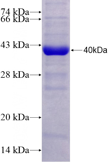 Recombinant Human EIF2S1 SDS-PAGE