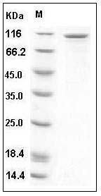 Human EphB6 / EphB6 Protein (Fc Tag) SDS-PAGE