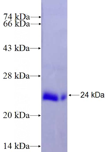 Recombinant Human HSPA14 SDS-PAGE