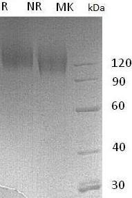 Human CEACAM5/CEA (His tag) recombinant protein