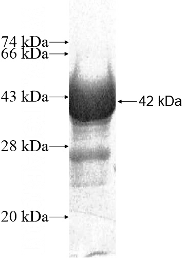 Recombinant Human MMRN1 SDS-PAGE