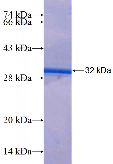 Human EFNA1 Recombinant protein (GST tag)