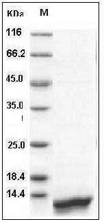 Human CCL14 / HCC-1 / HCC-3 Protein (His Tag) SDS-PAGE