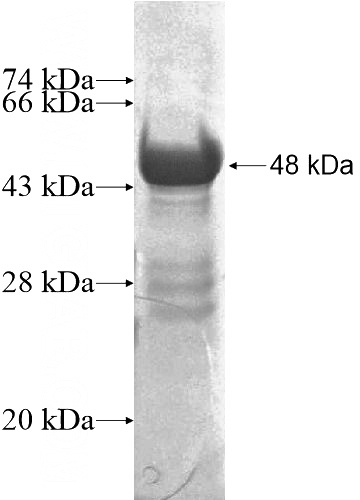 Recombinant Human MYH11 SDS-PAGE