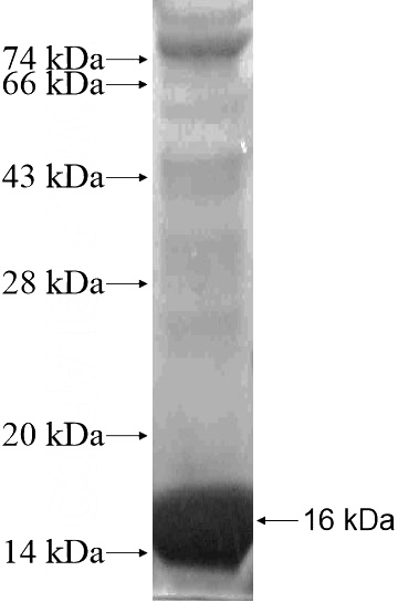 Recombinant Human KLK9 SDS-PAGE