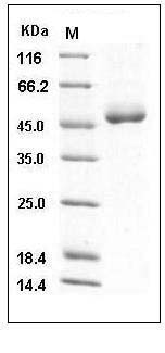 Mouse Cathepsin D / CTSD Protein (His Tag) SDS-PAGE