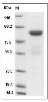 Rat Ephrin-A5 / EFNA5 Protein (Fc Tag) SDS-PAGE
