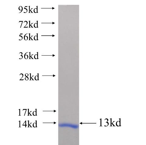 Recombinant human SLC2A12 SDS-PAGE
