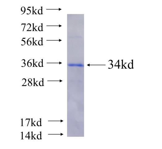 Recombinant human ATG2B SDS-PAGE