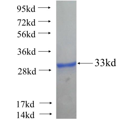 Recombinant human FGF20 SDS-PAGE