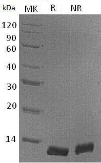 Mouse Ccl8/Mcp2/Scya8 (His tag) recombinant protein