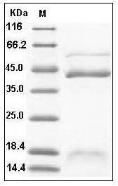 Human Inhibin beta B / INHBB / Activin B Protein (His Tag) SDS-PAGE