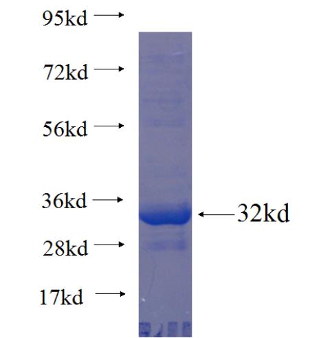 Recombinant human DECR2 SDS-PAGE