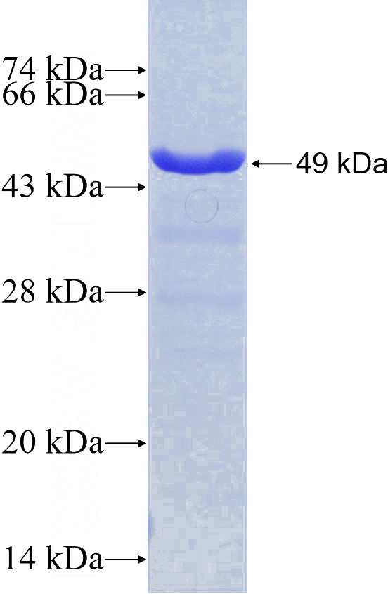 Recombinant Human UBE2E3 SDS-PAGE
