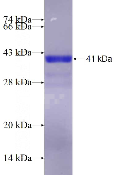 Recombinant Human PRKAR2B SDS-PAGE