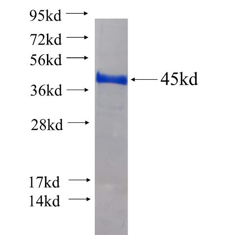 Recombinant human HMG20A SDS-PAGE