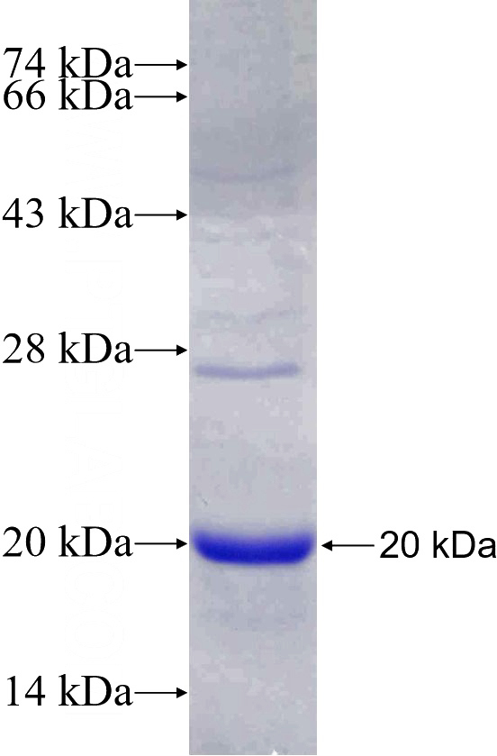 Recombinant Human KISS1 SDS-PAGE