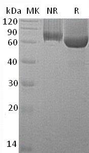 Mouse Gpc1 (His tag) recombinant protein