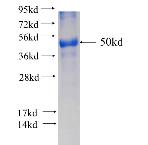 Recombinant human SALL2 SDS-PAGE