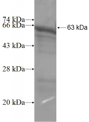 Recombinant Human DRG2 SDS-PAGE