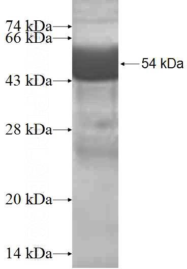 Recombinant Human CINP SDS-PAGE
