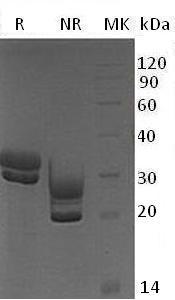 Mouse Klk7/Prss6/Scce (His tag) recombinant protein