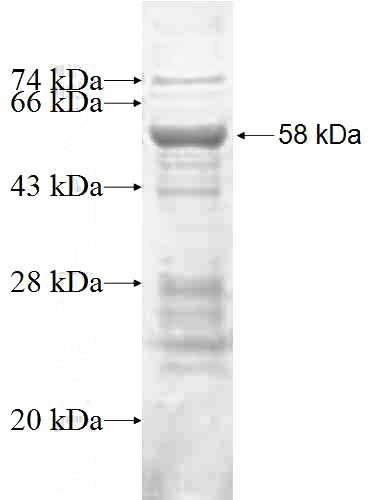 Recombinant Human FBXO27 SDS-PAGE